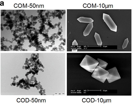 Electron Microscope images of nano-sized (left) and micron-sized (right) calcium oxalate crystals. Sun 2015