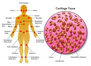 Cartilage sites and structure Copyright: rob3000 / 123RF Stock Photo